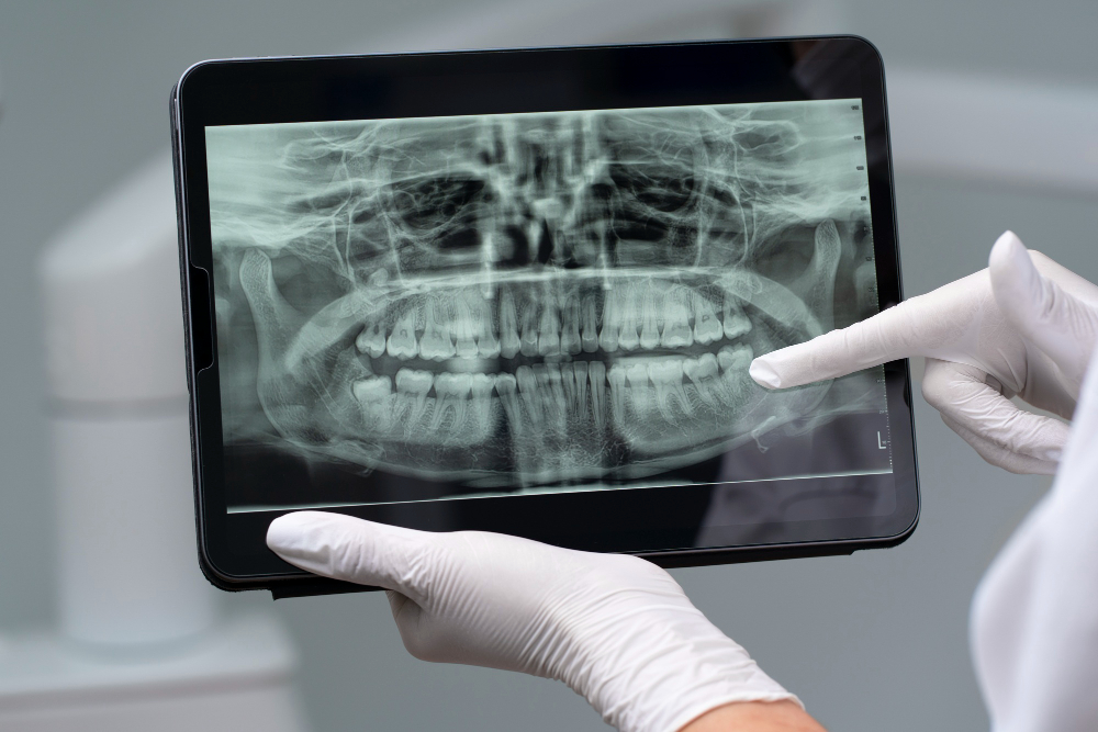 Digital X-Rays  Houston, TX