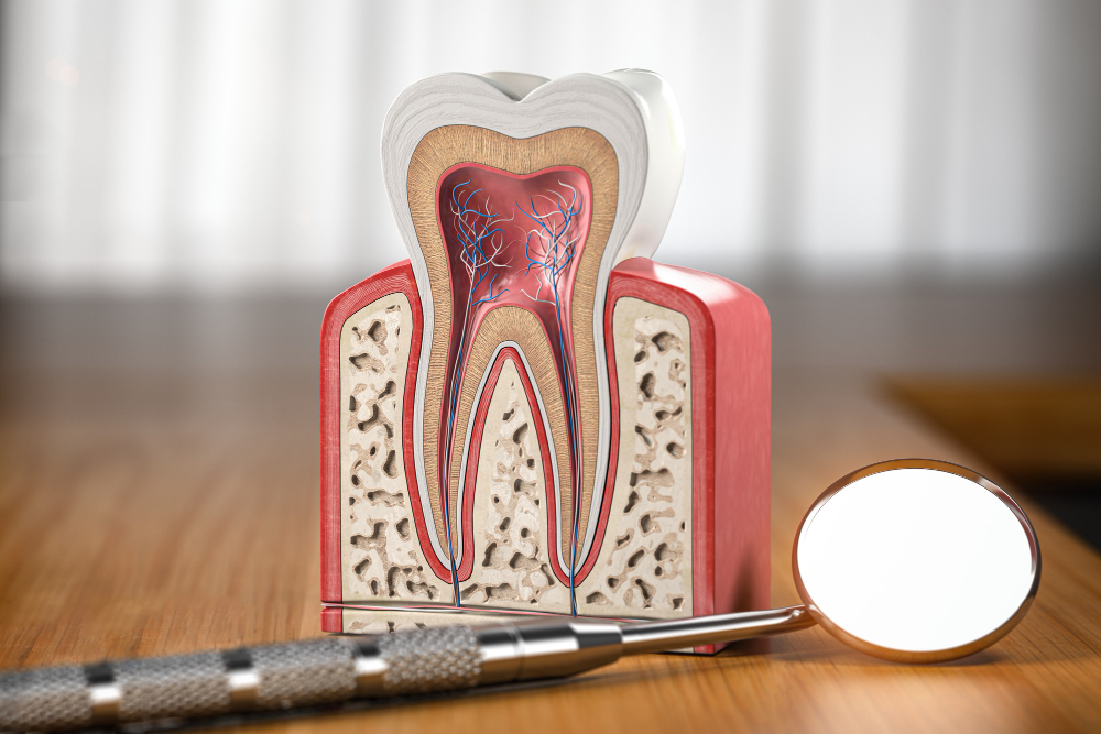 Root Canals  Houston, TX
